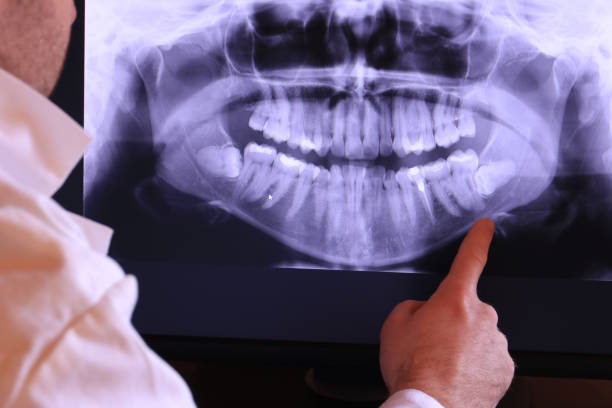 Best Emergency Tooth Extraction in Arcanum, OH